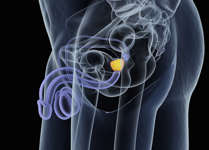 prostatitis men reddit prostatitis a férfiakban a rák jelei