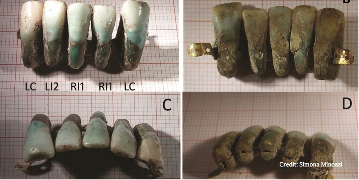 Italian false teeth