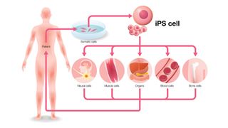 A diagram showing induced pluripotent stem cell (iPSCs) and their portantial for regenerative medicine.