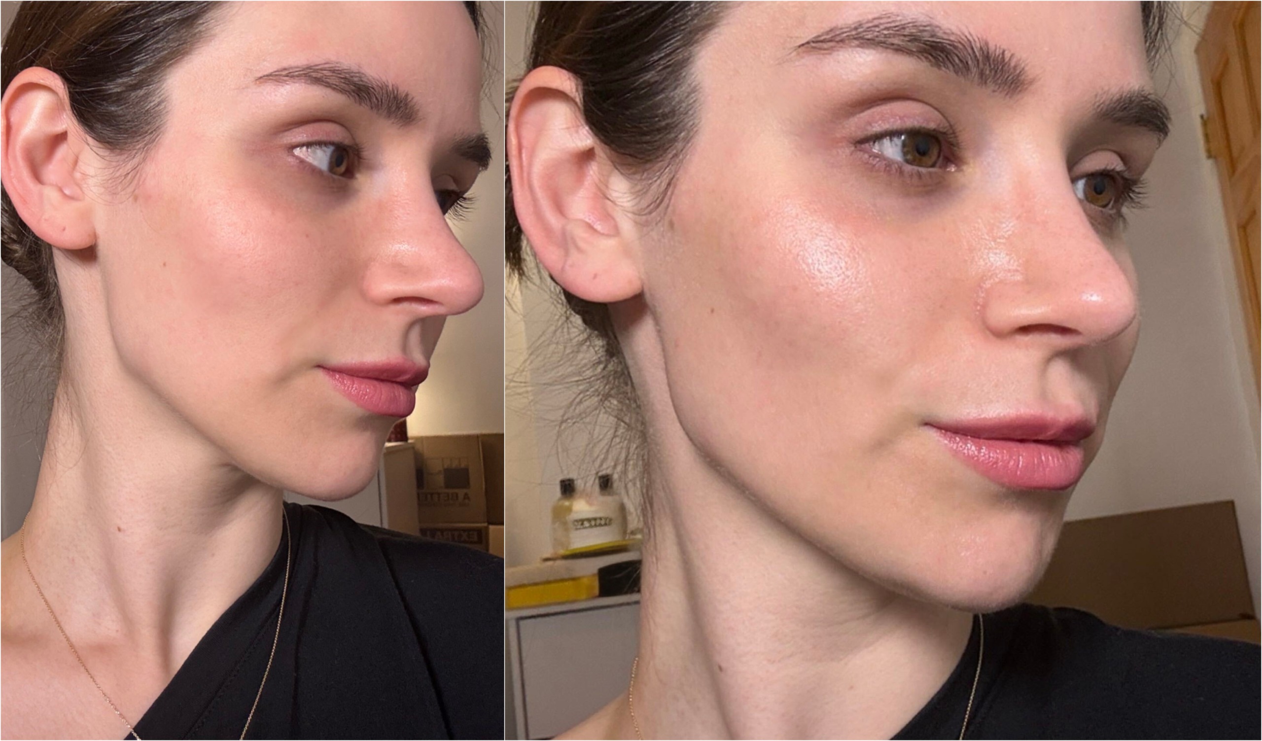 a close-up image of a girl before and after applying serum