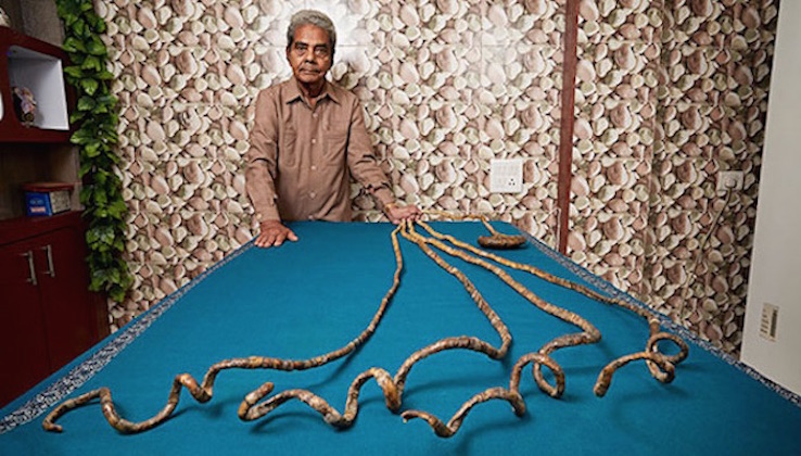 30-Foot Fingernails: The Curious Science of World's Longest Nails | Live  Science