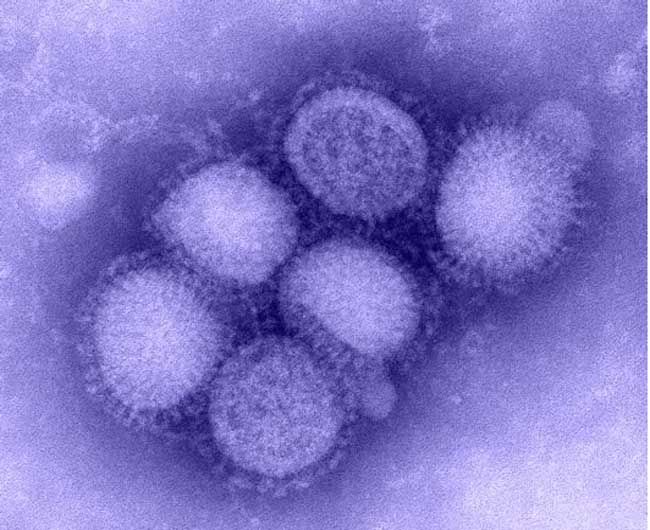 Innards Of H1N1 Virus Resemble 'Flu Sausage' | Live Science