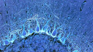 brain cells in the cerebellum pictured in a bright blue color