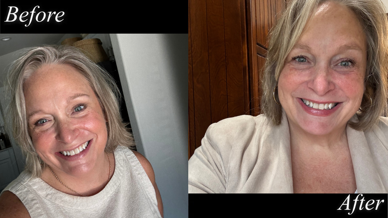 a woman with before and after photos wearing a white shirt and bare skin