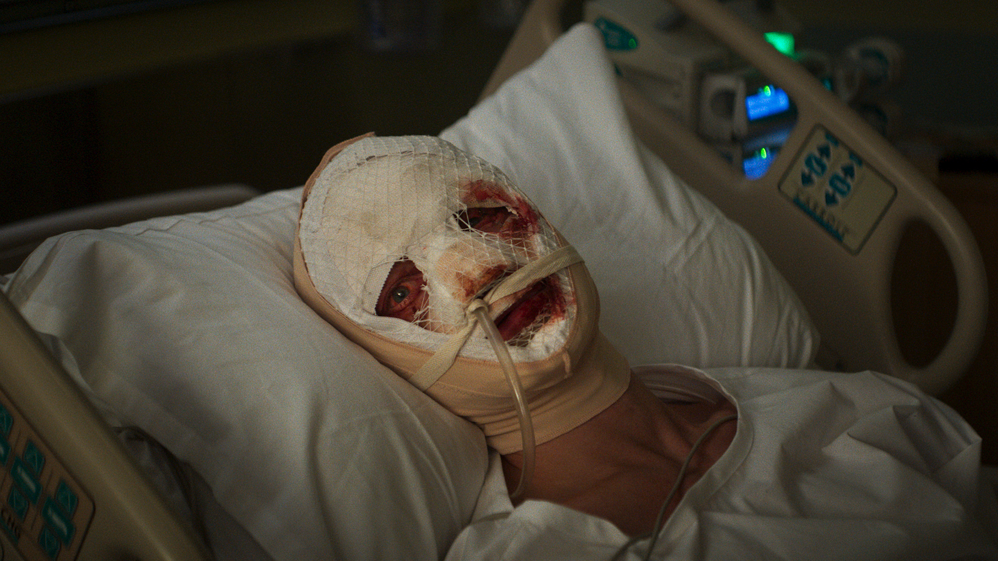 Tom Rhys Harries' Matt Hagen with a bandaged face and head in DC Studios' Clayface movie