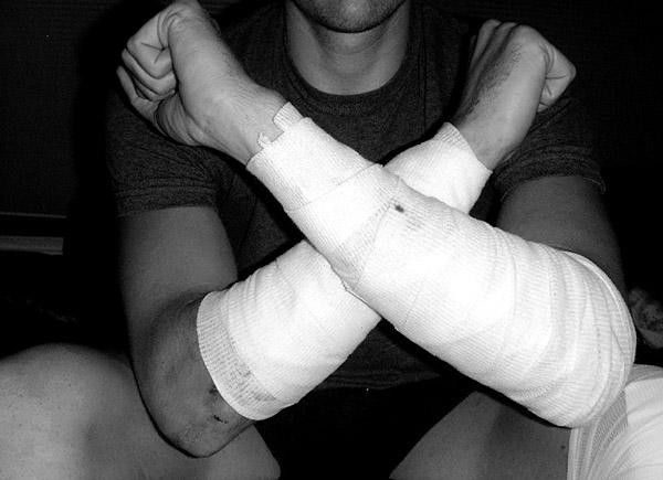 Battered and broken