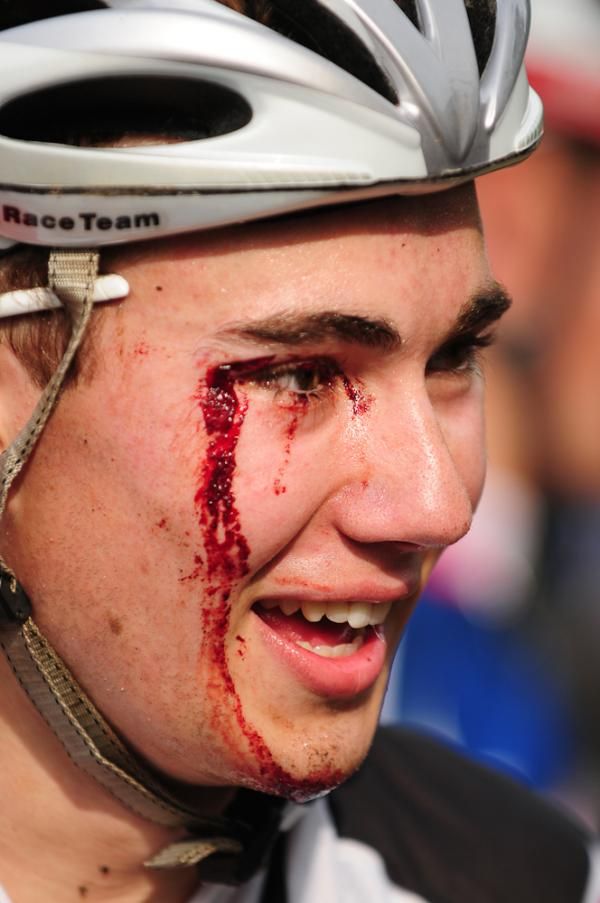 Sometimes mountain biking can be a contact sport.