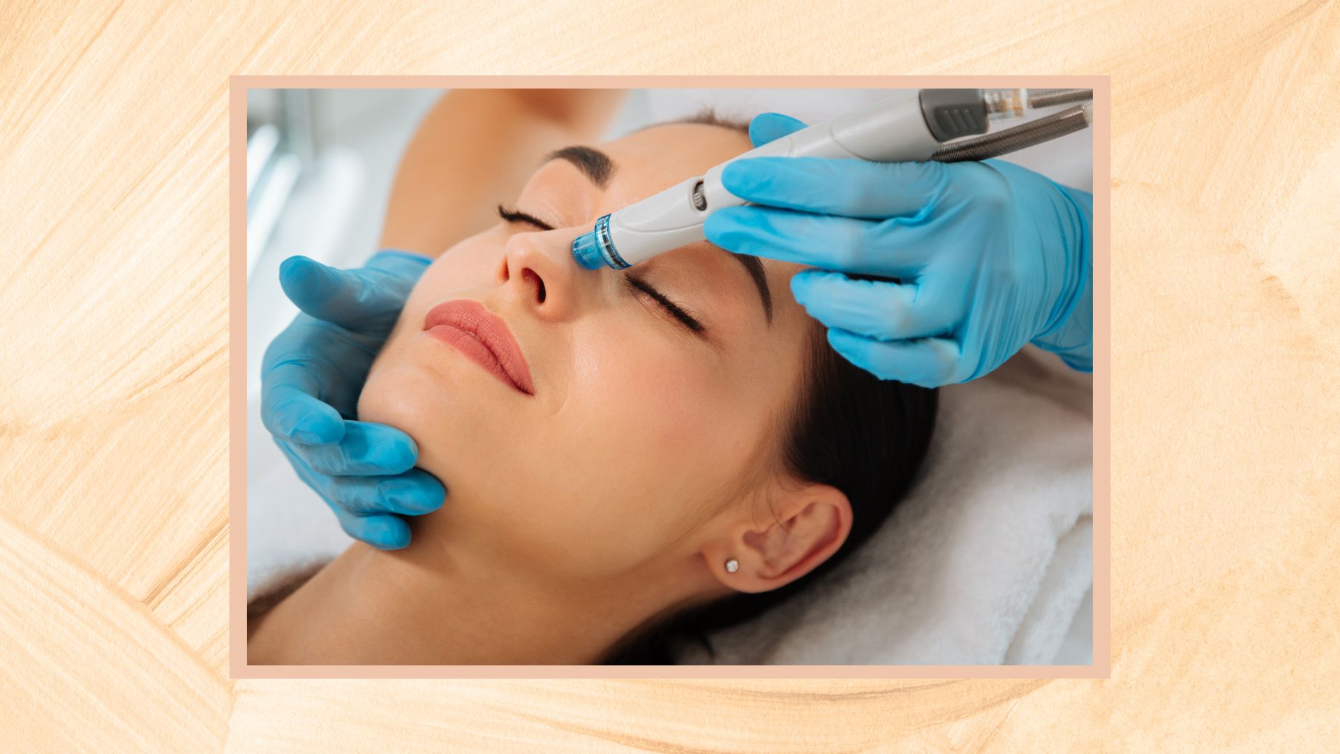 A yellow painted frame containing a close up image of a woman's face, with a blue gloved therapist's hand running a blue and white Hydrafacial vortex machine over her nose