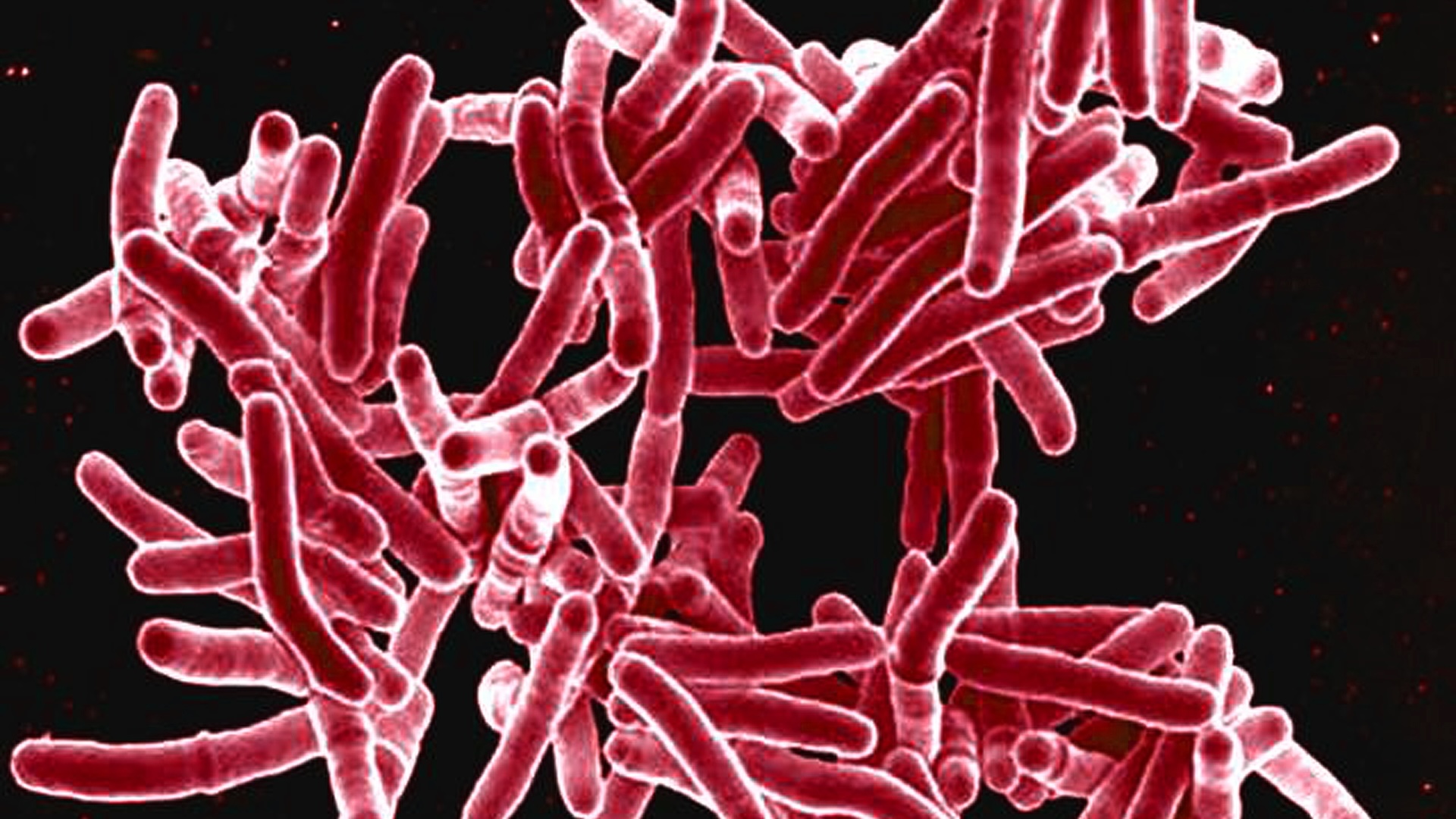 this digitally colorized scanning electron microscopic (SEM) image, depicts a grouping of red-colored, rod shaped, Mycobacterium tuberculosis bacteria