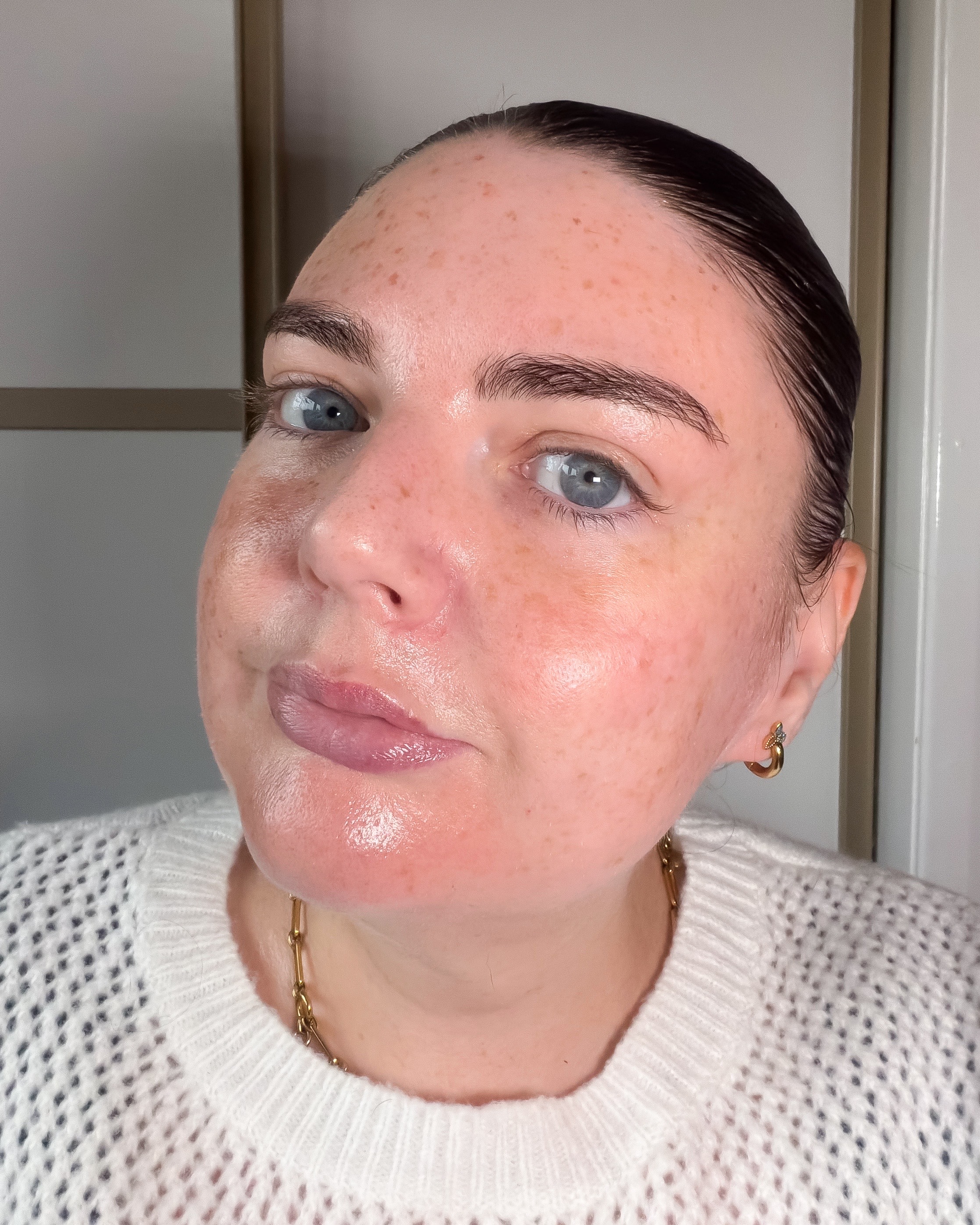 after facial cupping