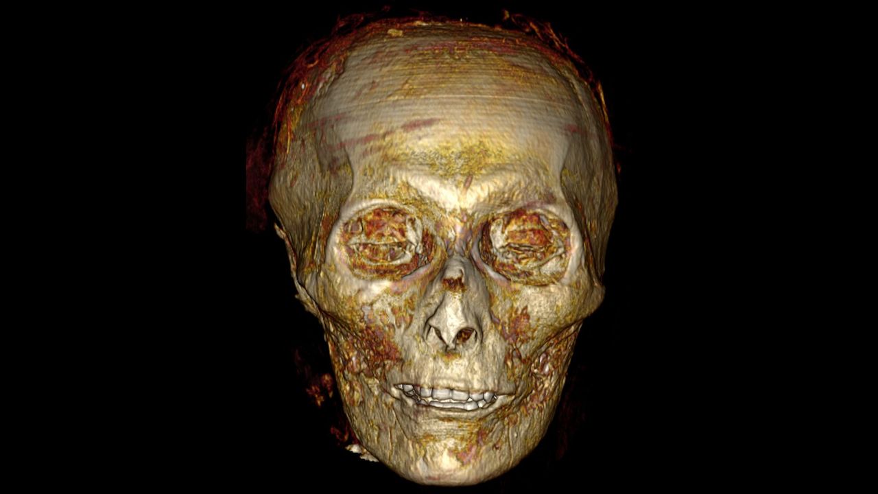 The pharaoh's skull showed his teeth were in good condition at the time of his death.