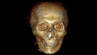 Le crâne du pharaon montrait que ses dents étaient en bon état au moment de sa mort.