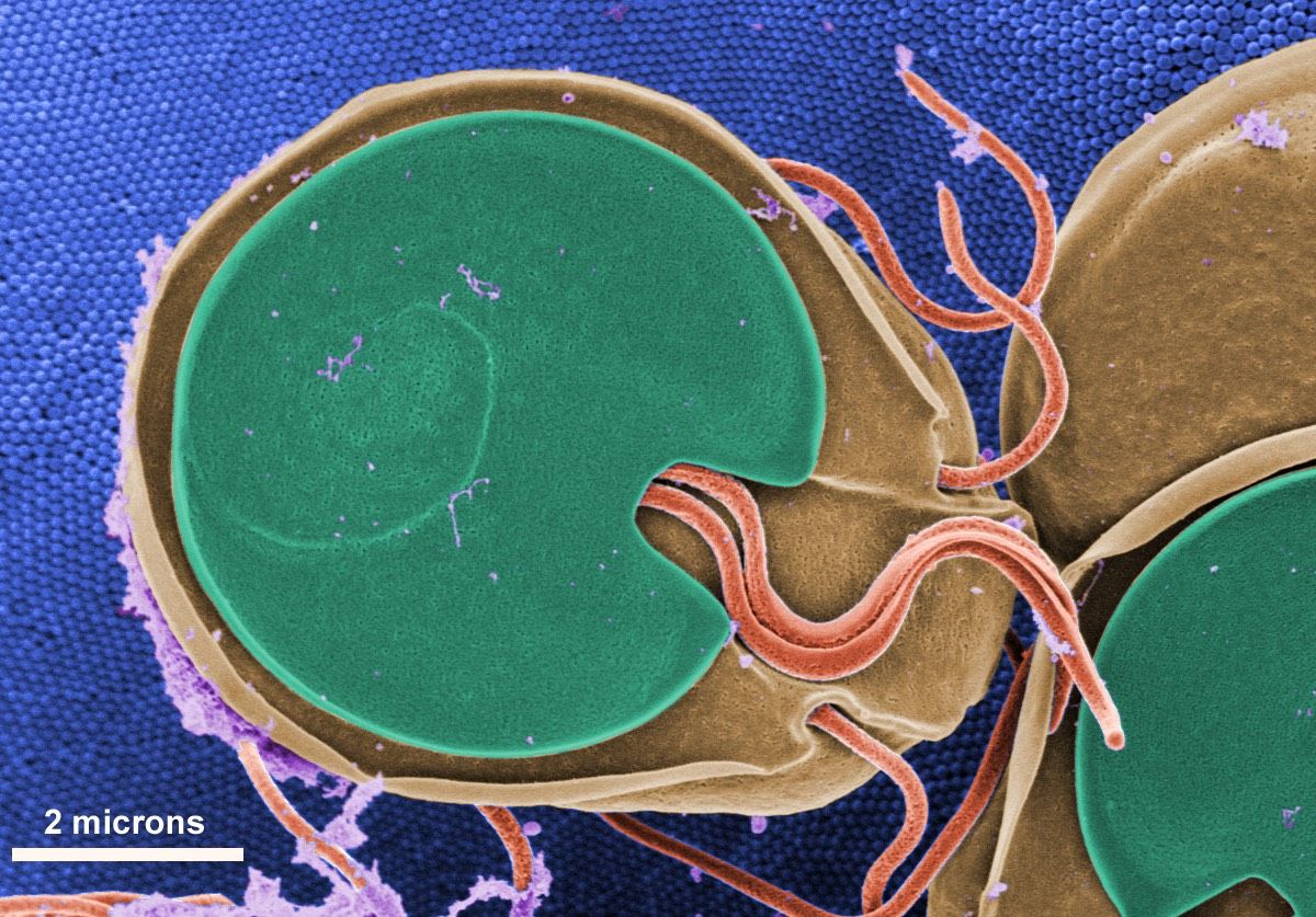 &lt;em&gt;Giardia&lt;/em&gt;, a parasitic protozoan transmitted by untreated drinking water, causes giardiasis, a diarrheal illness accompanied by nausea and fatigue. 