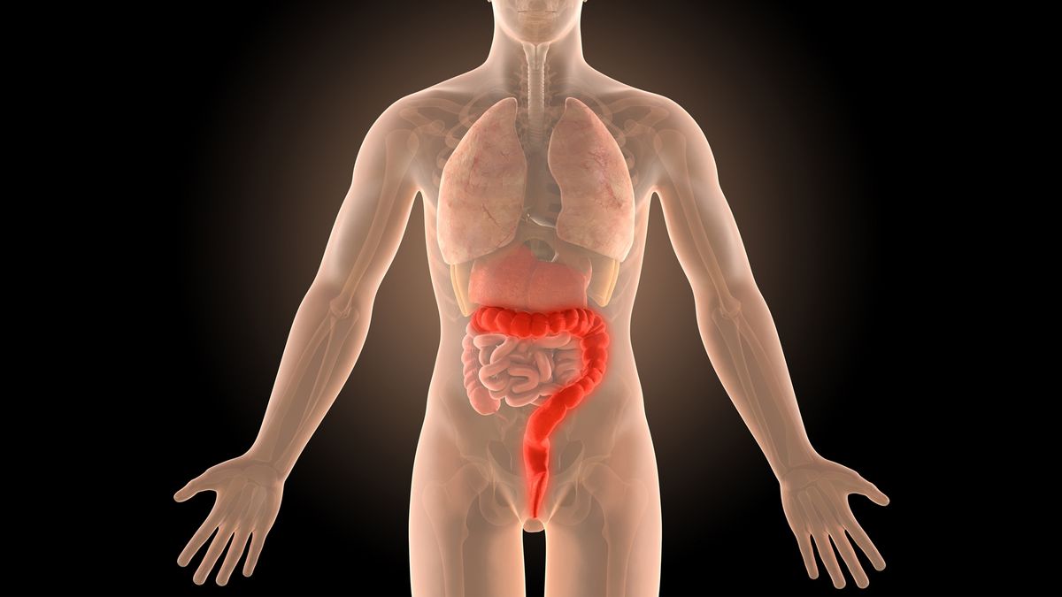 skeleton image of ulcerative colitis