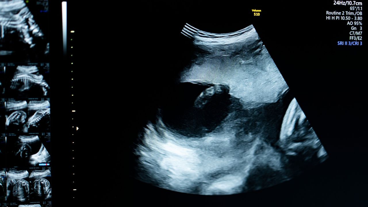 Wearable ultrasound tracks high-risk pregnancies: The Week's