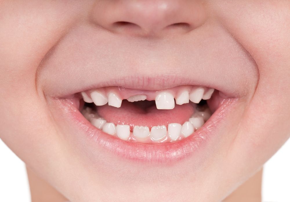 oral health, kids&#039; teeth, teething