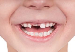 oral health, kids' teeth, teething