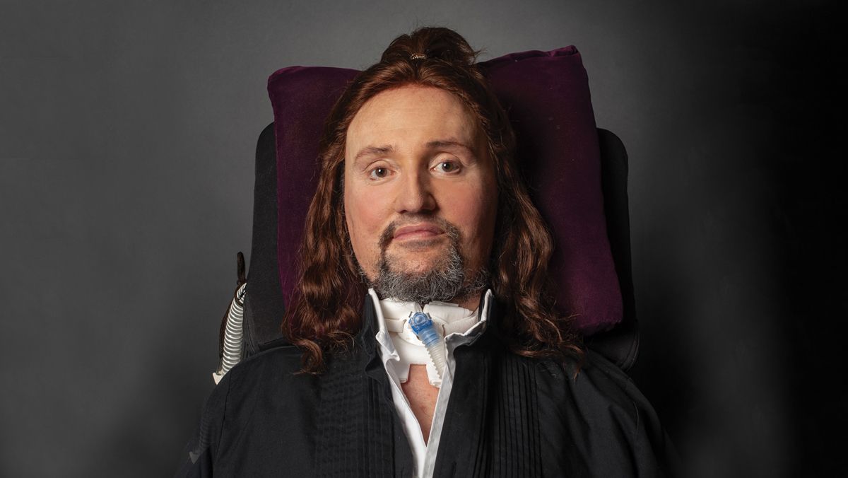 Jason Becker Before And After