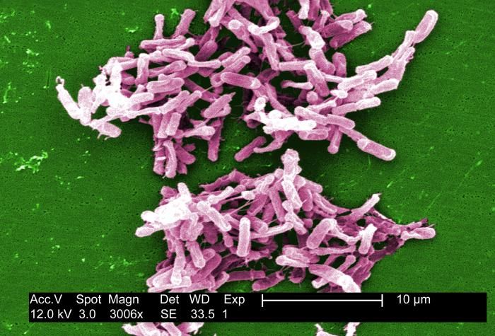 c-difficile