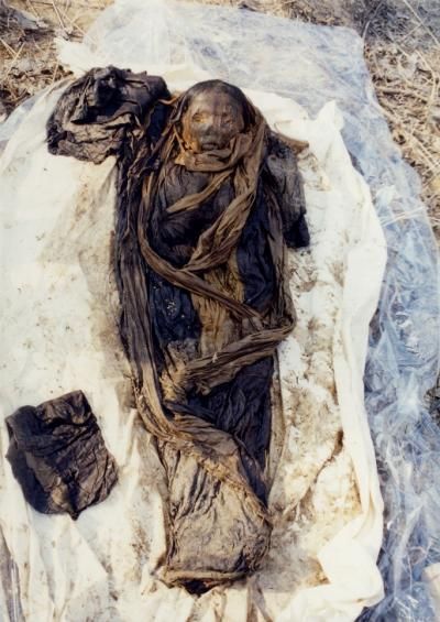 korean mummy child had hepatitis b