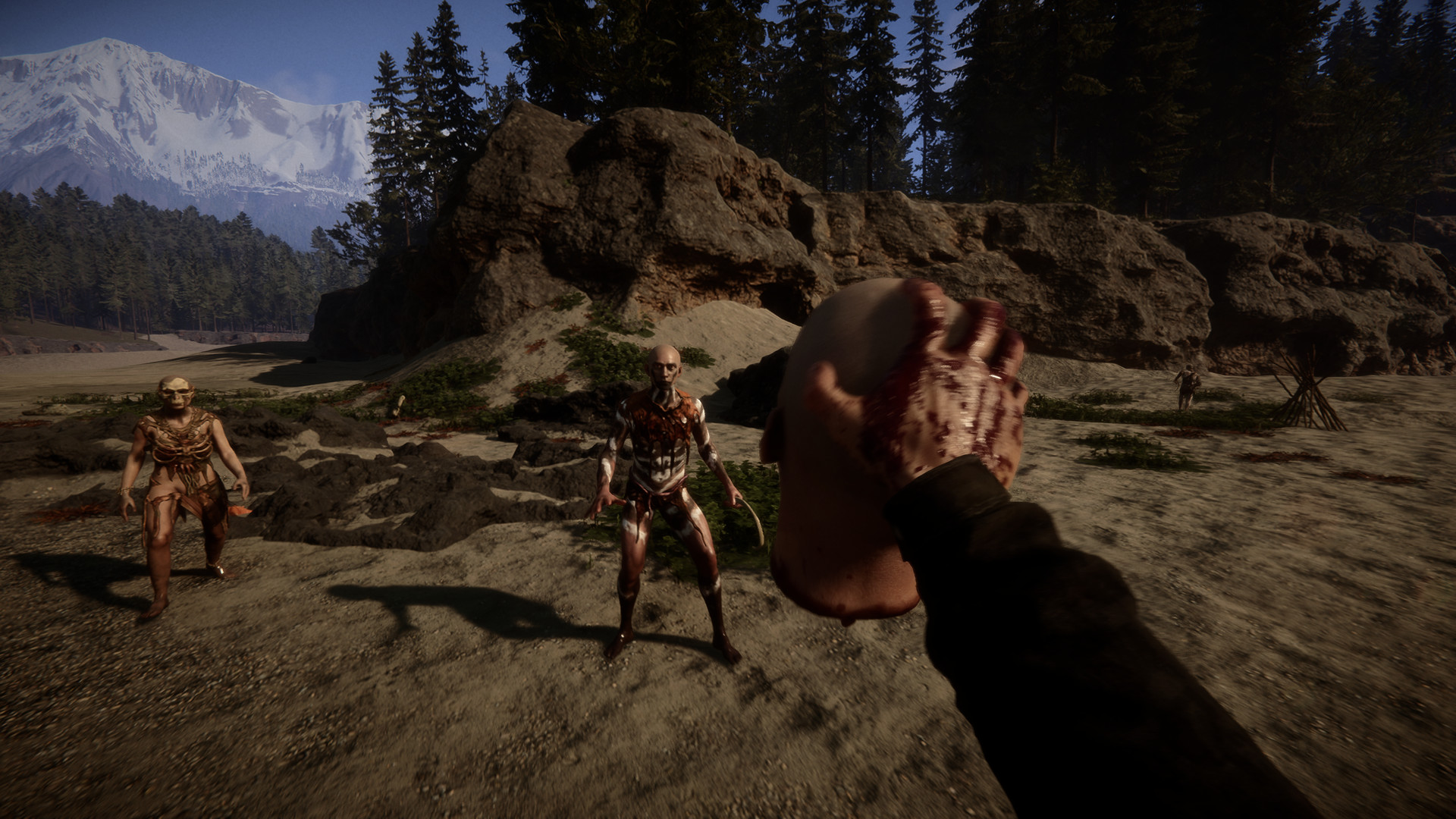 How to heal your companions in Sons of the Forest