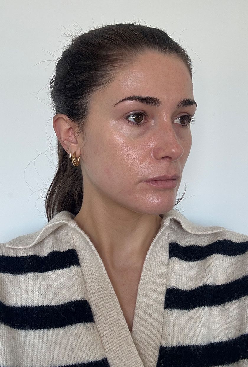 An 'after' picture of beauty editor Eleanor after using the Medik8 eye cream for two months