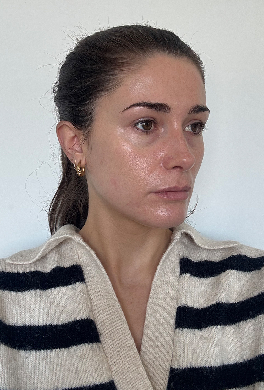 An 'after' picture of beauty editor Eleanor after using the Medik8 eye cream for two months