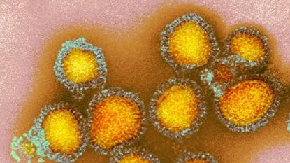 An electron microscope image of flu virus particles, depicted in yellow and orange
