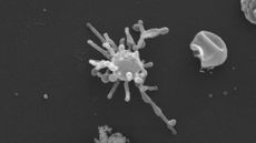a micrograph of an ancient microbe with a spherical main cell body and bumpy tentacles that extend outwards in all directions