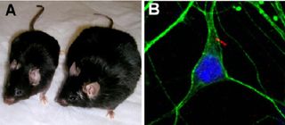 Panel A shows an obese mouse that has lost its cilia throughout the brain on the right and a normal littermate on the left. Panel B shows a brain cell (outlined in green) with a cilium contianing the MCH receptorin red.