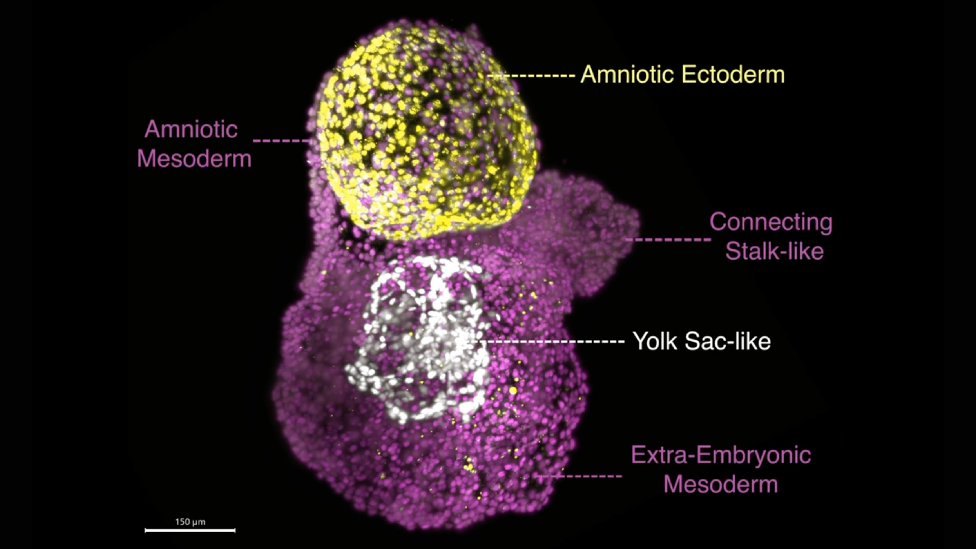 A labeled microscope image of a PGA, depicted in yellow, magenta and white
