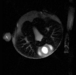 A still from the MRI video of the tarantula's heart beating.