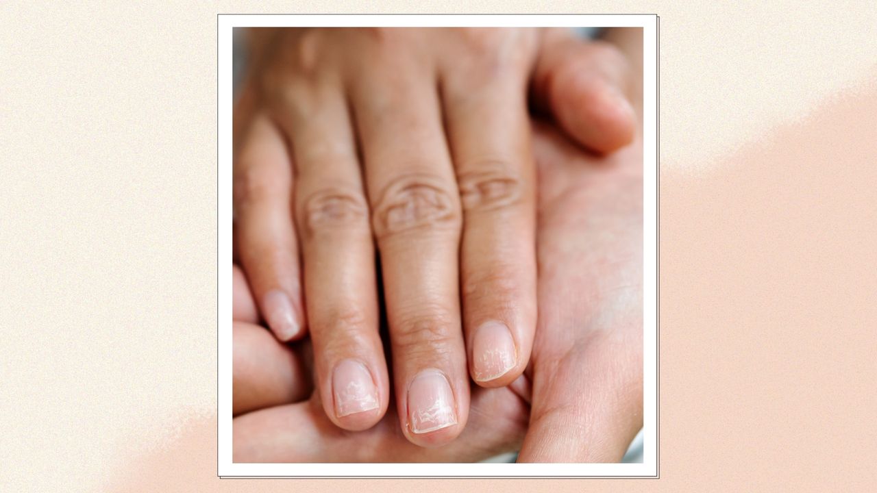 A close up of someone&#039;s hands with damaged and brittle nails/ in a cream and beige gradiant template