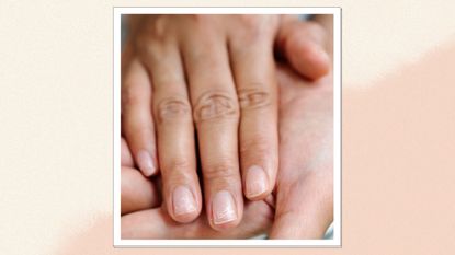 A close up of someone's hands with damaged and brittle nails/ in a cream and beige gradiant template