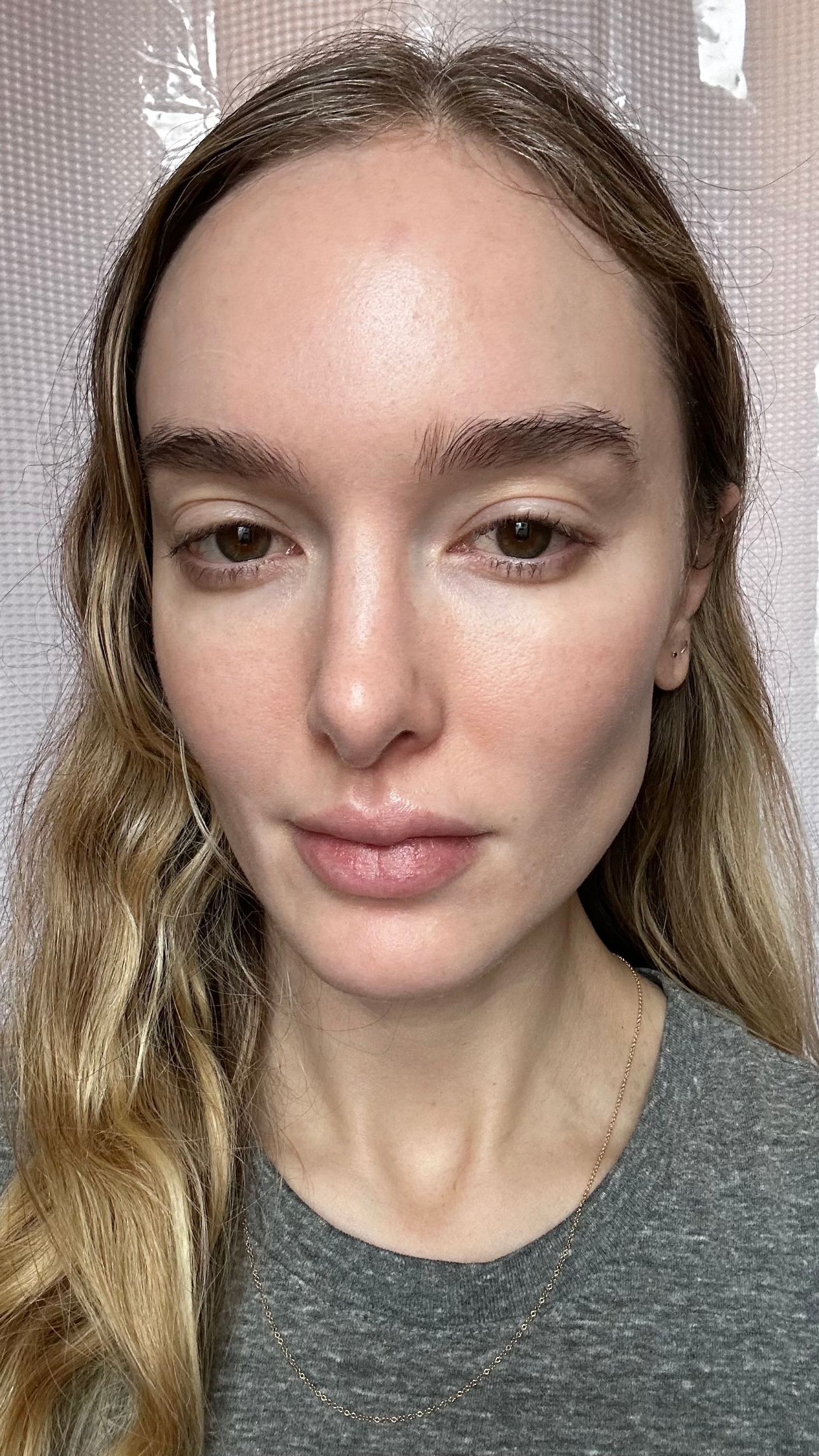 Hannah Baxter with bare skin