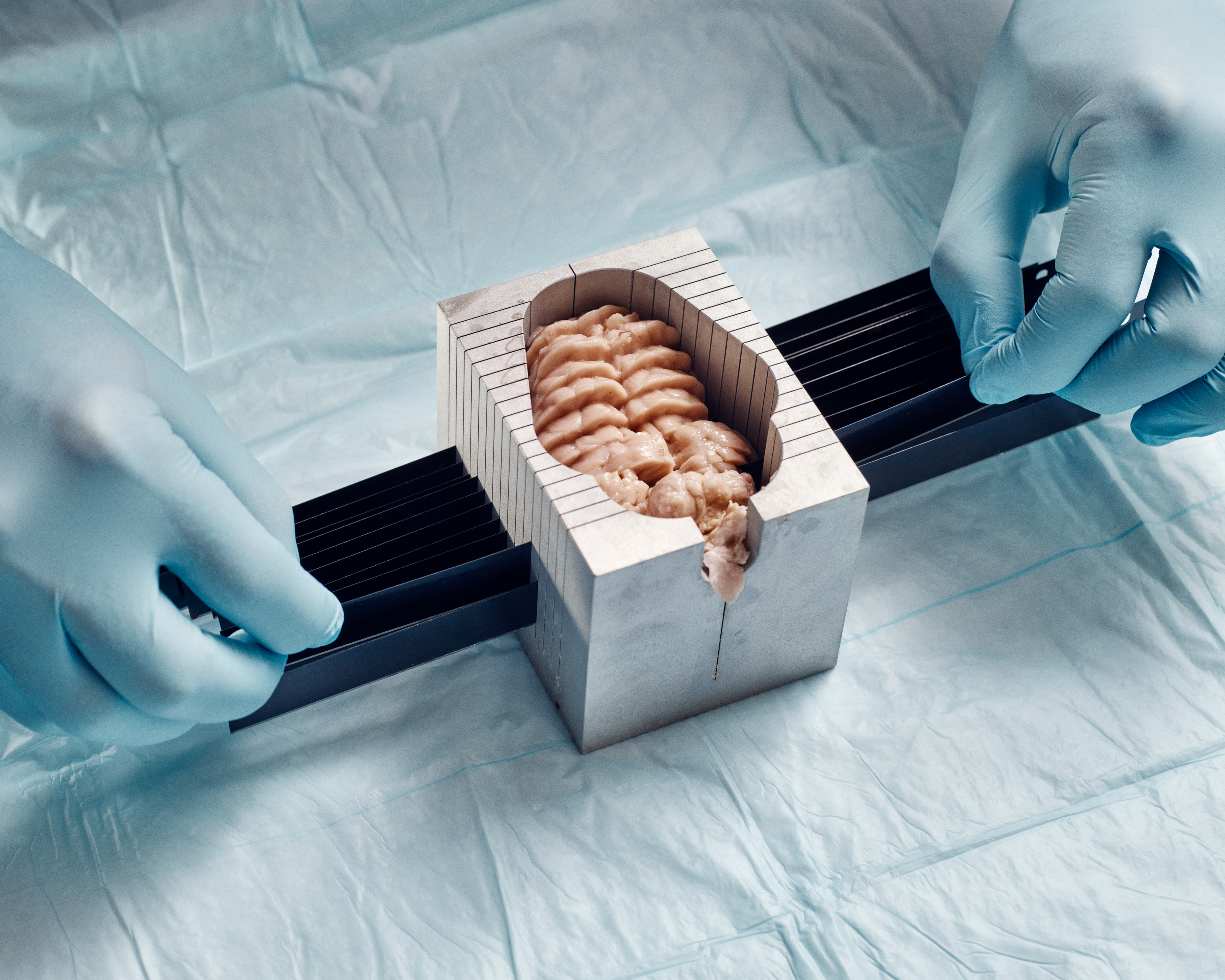 photography of a brain as subject of science experiment