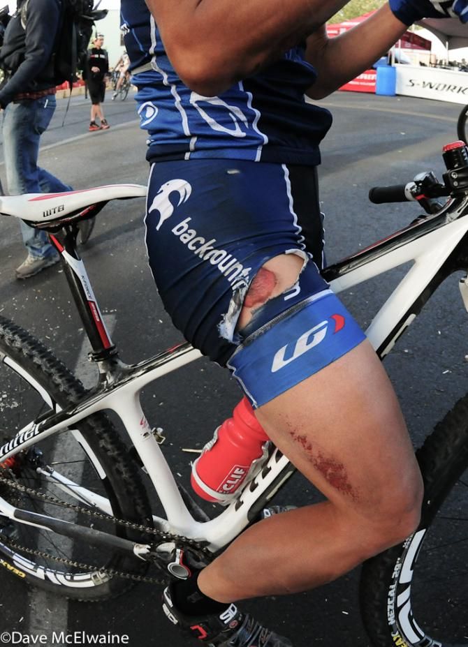 Evelyn Dong (Backcountry.com) lost some skin on a crash in front of the start/finish area