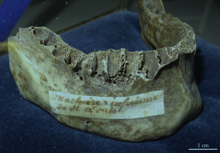 An image of the jaw shows an 18th Century parchment attached identifying it as belonging to Louis IX.