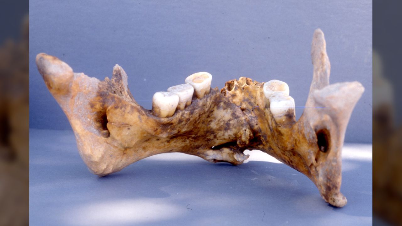 The interior of the healed warrior's jaw.