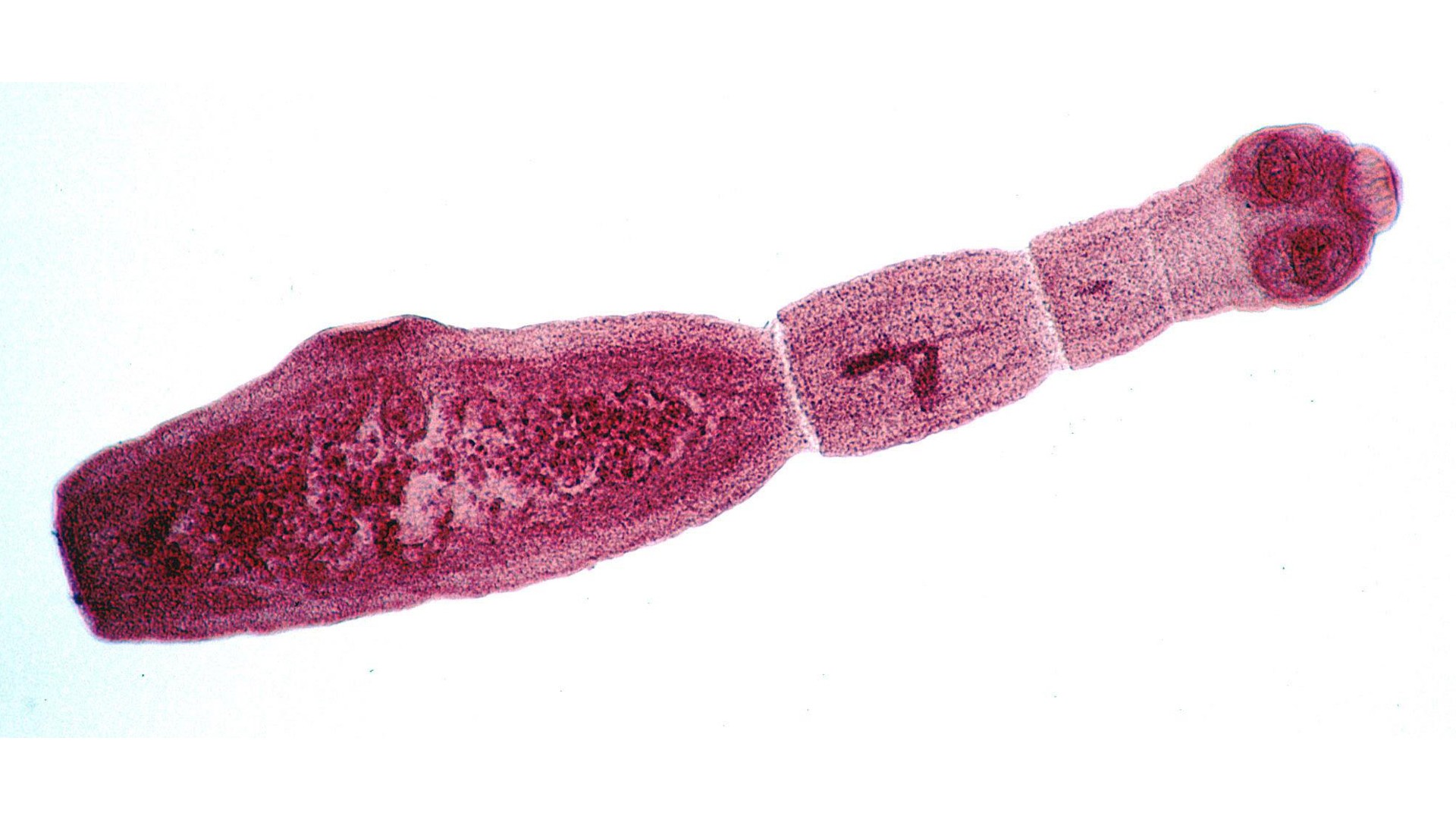 A photo of a tapeworm known as Echinococcus granulosus, which causes echinococcosis.