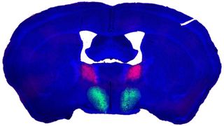 Composite image of the male mouse brain, shown in cross section, with the preoptic hypothalamus highlighted in green and the bed nucleus of the stria terminalis in a pinkish red