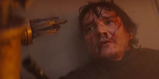 Pedro Pascal, who looks almost as bad as he did at the end of his run in "Game of Thrones."