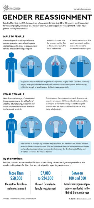 Infographics: How surgery can change the sex of an individual.