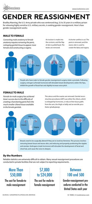 Sex Change Diagram Male To Female