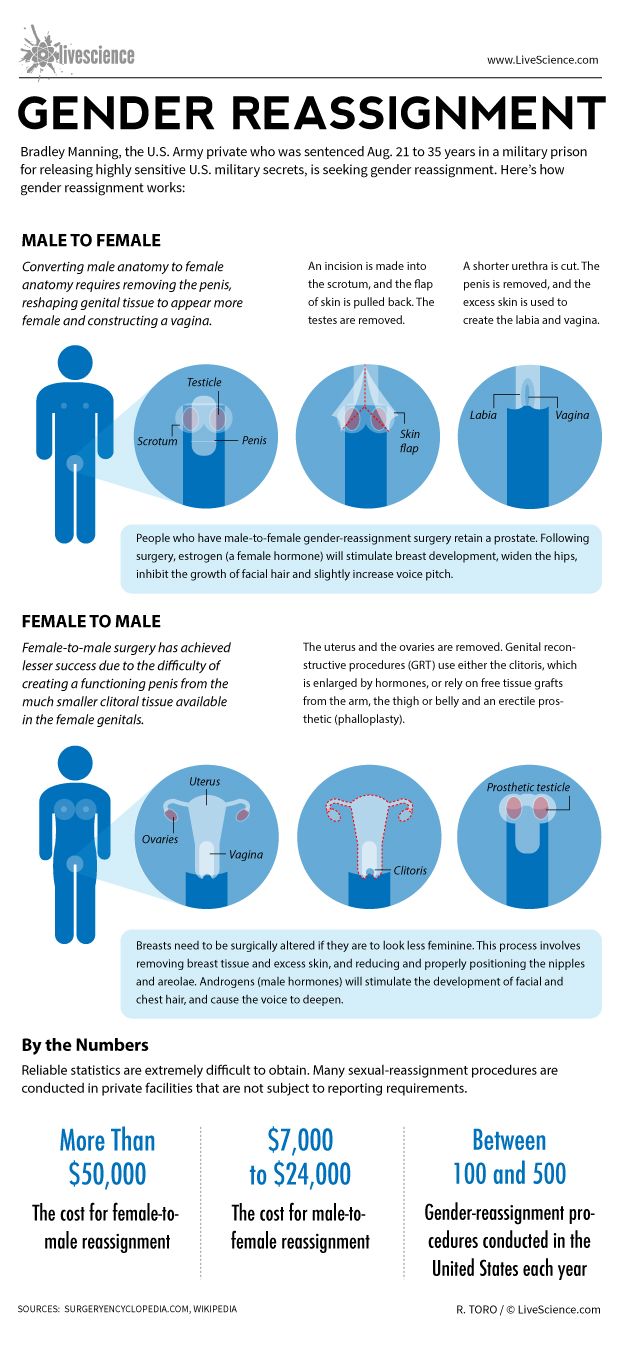 Infographics: How surgery can change the sex of an individual.