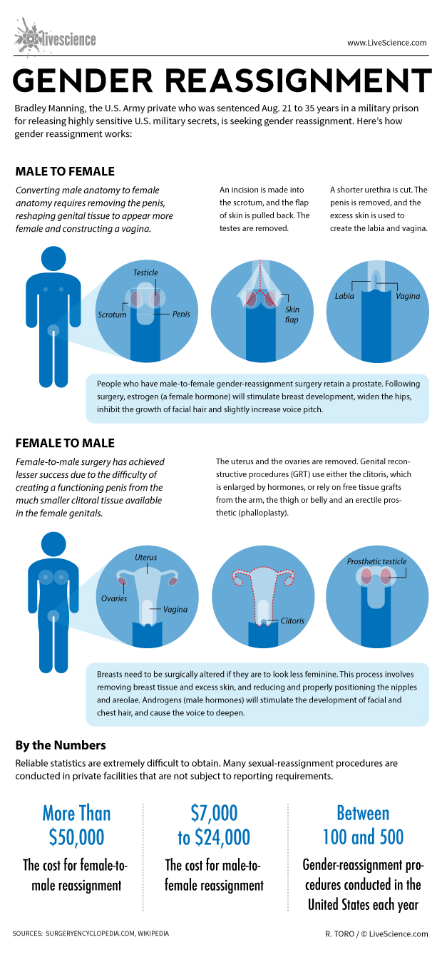How Gender Reassignment Surgery Works (Infographic) | Live Science