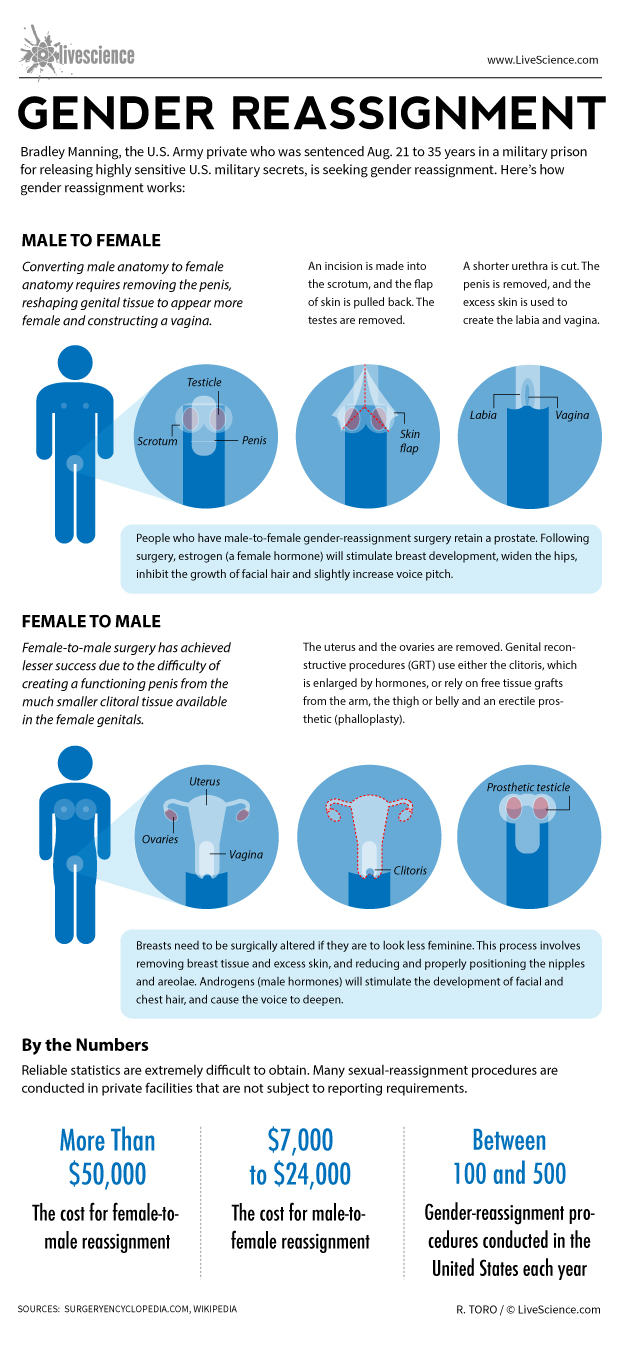 Hair Removal For Gender Reassignment Surgery Factory Sale