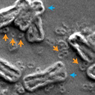 This image taken by a scanning electron microscope shows chromosomes (blue arrow) and ring-shaped DNA (orange arrow)