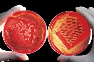 Infectious bacteria are cultured in labs while researchers try to figure out ways to fight them.