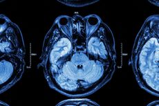 Stock photo of MRI scan showing brain and eyes.